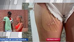 Aliud, expareja de la mujer que secuestró a otra y le quemó sus partes íntimas por celos: “Si consume heroína no es capaz de controlarse”