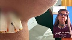 Ainhoa, víctima de una brutal paliza a manos de su ex, teme por su vida ante su inminente excarcelación: "No va a parar hasta matarme"