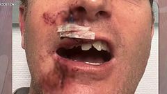 Un hombre denuncia haber recibido una brutal paliza tras pedir que no orinaran en su puerta: "Me quedé inconsciente"