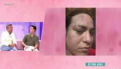 Valeri Cuellar, víctima de una brutal agresión en su propia casa