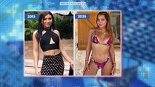¿Obsesionada con las operaciones?: el antes y el después de Daniela Requena tras 12 intervenciones quirúrgicas
