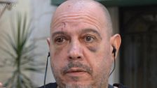 El duro testimonio de un hombre asaltado y brutalmente golpeado en Marbella: "Solo gritaba mientras me encañonaban con una pistola"