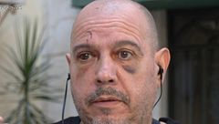 El duro testimonio de un hombre asaltado y brutalmente golpeado en Marbella: "Solo gritaba mientras me encañonaban con una pistola"