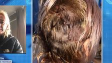 Una mujer, brutalmente atacada por dos perros tras proteger a su hijo de tres años: ''Me desgarró la cabeza''