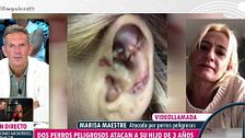 Los agónicos 13 minutos de la mujer que fue agredida por dos perros junto a su hijo: "Mi niño me decía: 'Llama a papá, nos va a matar'"