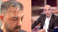 Nacho Abad, al ver las secuelas de Luis tras recibir una salvaje paliza: "Tienes los ojos reventados en sangre"