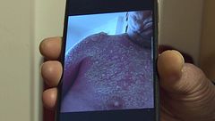 Un paciente con TOC de orden y simetría revela a 'Callejeros' las consecuencias ocultas: "Duele muchísimo"