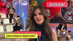 Alexia Rivas actualiza cómo evoluciona su alopecia areata