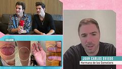 Juan Carlos Oviedo, hermano de los 'Gemeliers': "Los agresores salieron a la caza del famoso"