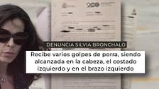 La denuncia de Silvia Bronchalo a la vigilante de seguridad de su urbanización, en exclusiva: “Recibió golpes de porra en la cabeza y en el costado”