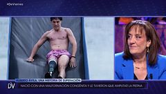 La importante reivindicación de la madre de Alberto Ávila, el primer deportista paralímpico de 'Supervivientes': "No hagáis hincapié en eso"