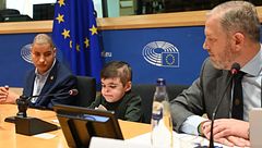 El triunfo del pequeño Leo: Andalucía le facilitará el medicamento que curará las heridas crónicas de la 'piel de mariposa'