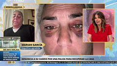 Inquilina agredida por su casero para que abandone su casa: "Vivo en un sin vivir, amenazada de muerte"