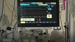 Construyen un dispositivo especial para que una mujer logre un suicidio asistido usando sus ojos en Italia