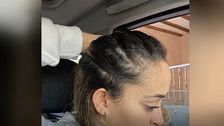Un peinado viral está provocando alopecia entre las chicas jóvenes