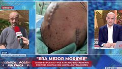 Un policía apaleado por okupas denuncia que le obligan a regresar a su puesto de trabajo sin estar recuperado: “Me mandan a la calle y con un arma”