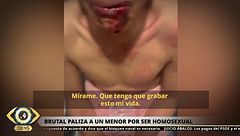 Brutal agresión homófoba a un menor en Sevilla: "Solo quiero ser feliz como soy"