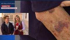 Brutal agresión a un anciano de 93 años para robarle apenas 10 euros