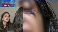 El demoledor testimonio de Julia, la mujer maltratada y secuestrada en una caravana por su pareja en Murcia: “Él está en libertad y nosotros escondidos y atemorizados”