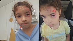 Las heridas de Lina, una niña con discapacidad de Castellón, a la que robaron su silla eléctrica: se ha caído en el colegio