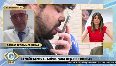 'Gimnasio bucal': Una aplicación para el móvil podría ser la solución a los ronquidos