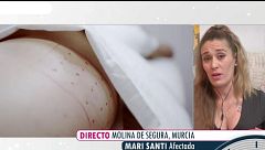 Mari Santi perdió el pezón y la areola tras una presunta mala praxis durante su operación de pecho: "Ahora me encuentro peor que antes"
