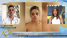 Julio Núñez, el ciclista arrollado en Lisboa: “Estoy contento de estar vivo”