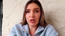 Patri confiesa si va a quitarse el lunar que tiene en el labio