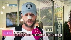 José Antonio Canales Rivera, operado para quitarse unas células cancerígenas en la nariz por culpa del sol