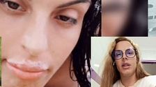 Yarelis, víctima de una clínica estética ilegal: “Me inyectaron silicona industrial en lugar de ácido hialurónico”
