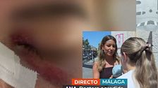 Una doctora denuncia la agresión de un paciente: “Me rompió la nariz y no tiene orden de alejamiento”