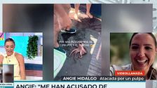 Angie Hidalgo, atacada por un pulpo: "Volvió al mar, pero me han atacado en las redes sociales”