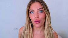 Claudia habla de su gran brote de acné: el tratamiento que sigue