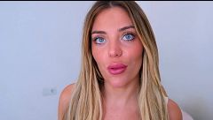 Claudia habla de su gran brote de acné: el tratamiento que sigue