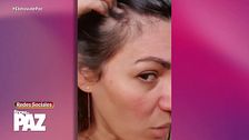 Fabiola Martínez y otras famosas que sufrieron alopecia: "Cuando lo vi me puse a vomitar"