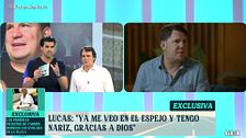 Todos los detalles de la segunda operación de nariz de Lucas: "Va a emprender un nuevo proyecto y seguramente incluya todo este proceso"