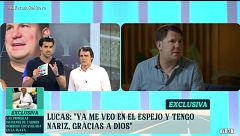 Todos los detalles de la segunda operación de nariz de Lucas: "Va a emprender un nuevo proyecto y seguramente incluya todo este proceso"