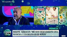 Bigote Arrocet, muy preocupado por su salud: "Le han visto un bulto y está a la espera de los resultados"