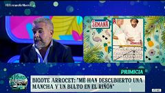 Bigote Arrocet, muy preocupado por su salud: "Le han visto un bulto y está a la espera de los resultados"