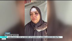 Una mujer es atacada a ladrillazos en Ceuta con su bebé en brazos: "Vi la muerte"