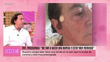 Pipi Estrada, preocupado por una lesión en la sien: "Me han hecho una biopsia, estoy esperando resultados"