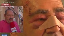 Agreden a un anciano de Lorca con un puño americano: “No quería ni robarme”