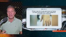 El presidente del Colegio de Médicos de Ceuta confirma el primer caso de viruela del mono: “Nos los han confirmado”