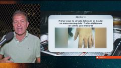 El presidente del Colegio de Médicos de Ceuta confirma el primer caso de viruela del mono: “Nos los han confirmado”