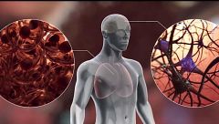 Unos investigadores españoles descubren cómo se podría extinguir el cáncer: "Hay una fase donde las células se apagan"