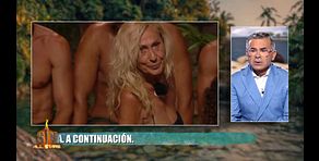 Jorge Javier Vázquez, atónito ante las picaduras que cubren las piernas de Rosa Benito: "¡Ostras!"