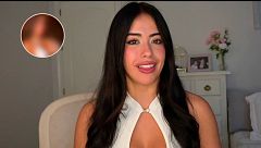 Gema (‘LIDLT’) enseña el antes y después de su operación de pecho: el motivo por el que pasó por quirófano