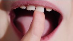 Los dientes de leche, esperanza contra enfermedades neurodegenerativas: sus células pueden transformarse en neuronas