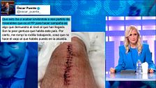 El 29N se juega en las redes: El PP se ríe del esguince de Óscar Puente