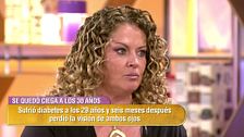 Sol cuenta cómo afrontó su pérdida de visión a los 30 años: "Cuando me dieron la noticia, fue un shock"